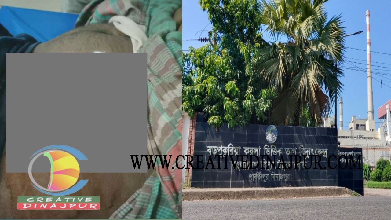 তাপবিদ্যুৎ কেন্দ্রে দূর্ঘটনায় শ্রমিক আহত